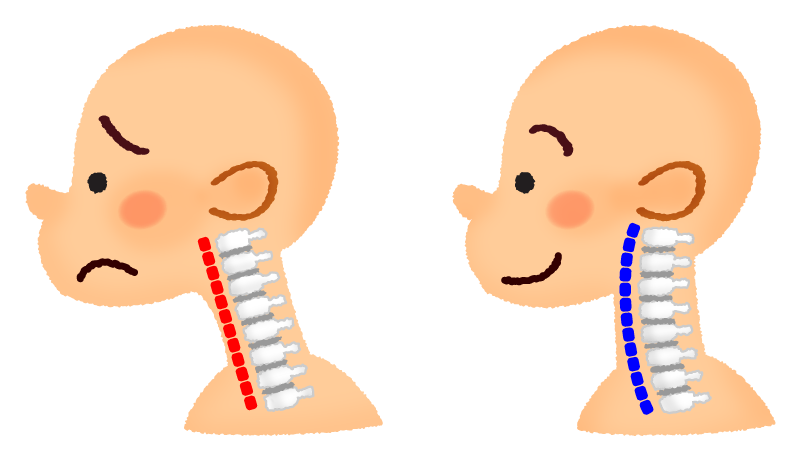 ストレートネック